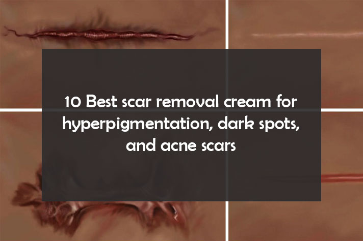 best products for acne scars and hyperpigmentation